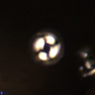 Coccolithus formosus VR 00923