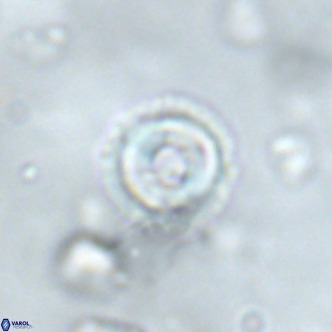 Coccolithus formosus VR 02068
