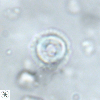 Coccolithus formosus VR 02068