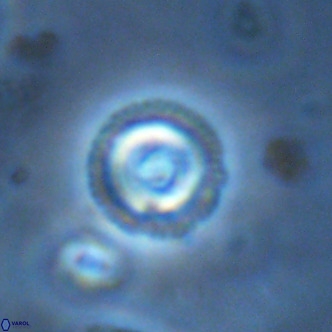 Coccolithus formosus VR 02069