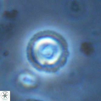 Coccolithus formosus VR 02069