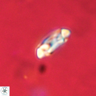 Coccolithus formosus VR 02077