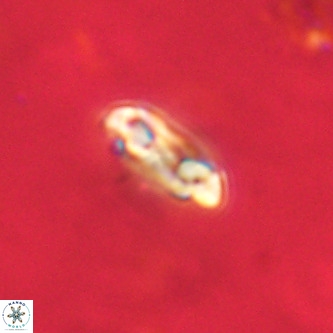 Coccolithus formosus VR 02081