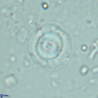 Coccolithus formosus VR 02514