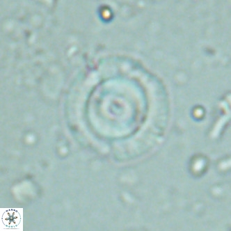 Coccolithus formosus VR 02514