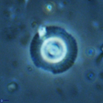 Coccolithus formosus VR 02515