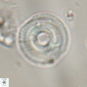 Coccolithus formosus VR 30766