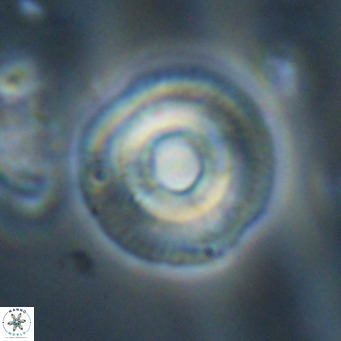 Coccolithus formosus VR 30767