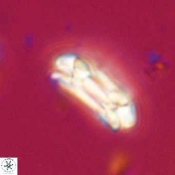 Coccolithus formosus VR 30770
