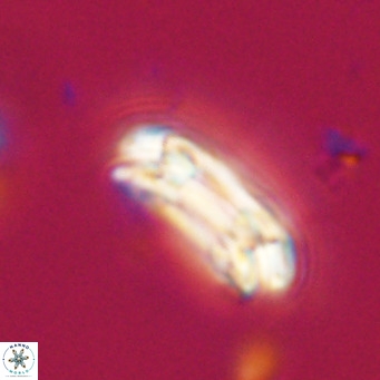 Coccolithus formosus VR 30773