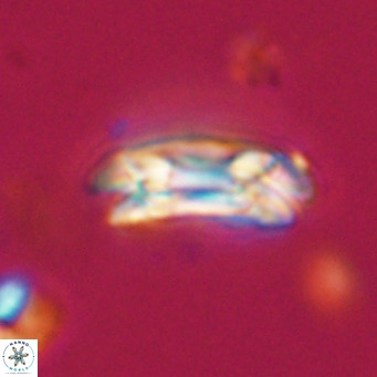 Coccolithus formosus VR 30776