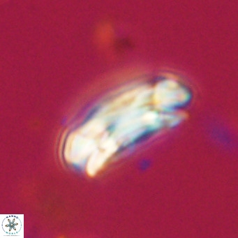 Coccolithus formosus VR 30777