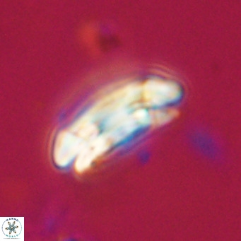 Coccolithus formosus VR 30779