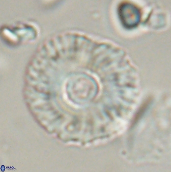 Coccolithus gracejacovidesiae 58957