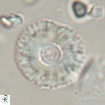 Coccolithus gracejacovidesiae 58957