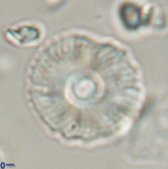 Coccolithus gracejacovidesiae 58960