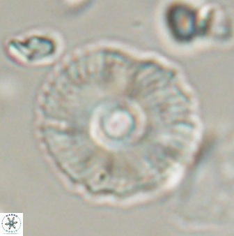 Coccolithus gracejacovidesiae 58960