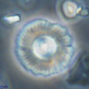 Coccolithus gracejacovidesiae 58961