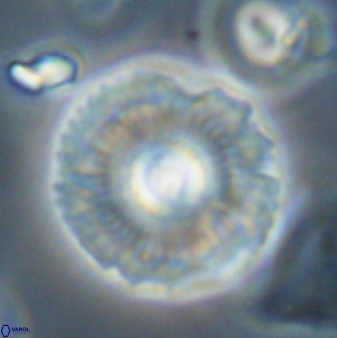Coccolithus gracejacovidesiae 58962
