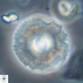 Coccolithus gracejacovidesiae 58962