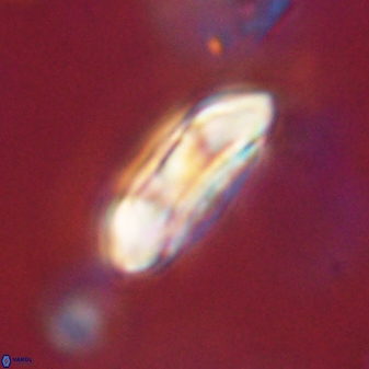 Coccolithus gracejacovidesiae 58972