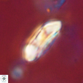 Coccolithus gracejacovidesiae 58972