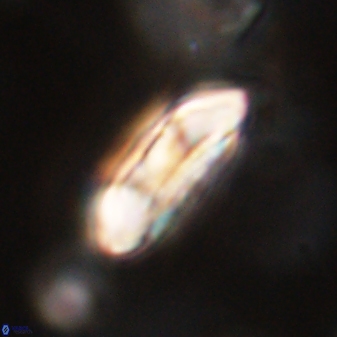 Coccolithus gracejacovidesiae 58973