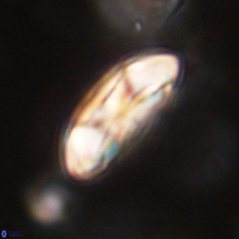 Coccolithus gracejacovidesiae 58974
