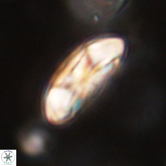 Coccolithus gracejacovidesiae 58974