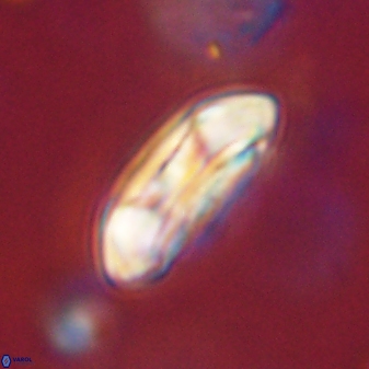 Coccolithus gracejacovidesiae 58975