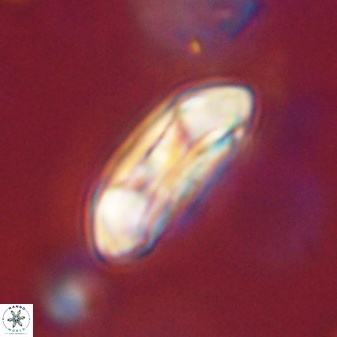 Coccolithus gracejacovidesiae 58975