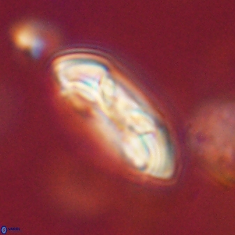 Coccolithus gracejacovidesiae 58976