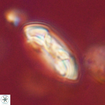 Coccolithus gracejacovidesiae 58976