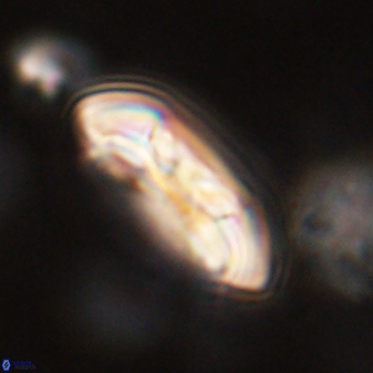 Coccolithus gracejacovidesiae 58977