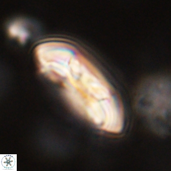 Coccolithus gracejacovidesiae 58977