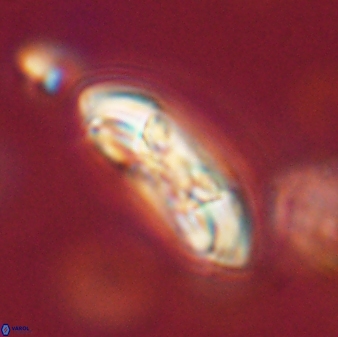 Coccolithus gracejacovidesiae 58979