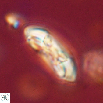 Coccolithus gracejacovidesiae 58979