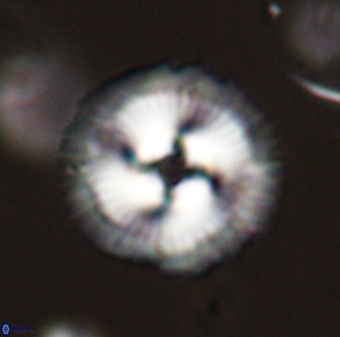 Coccolithus gracejacovidesiae 58985