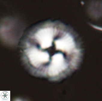 Coccolithus gracejacovidesiae 58985
