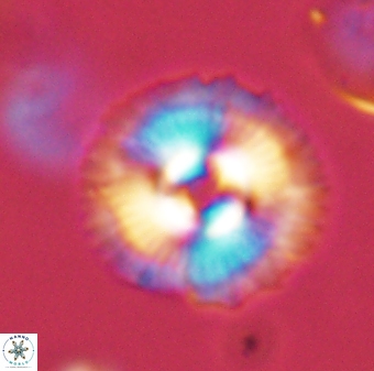 Coccolithus gracejacovidesiae 58986