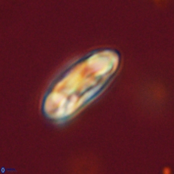 Coccolithus gracejacovidesiae 67872