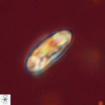 Coccolithus gracejacovidesiae 67872