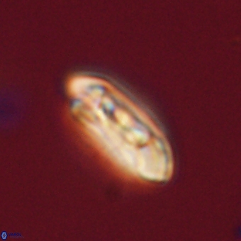 Coccolithus gracejacovidesiae 67879