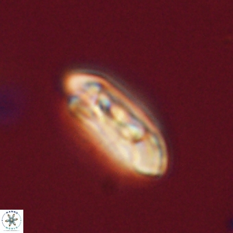 Coccolithus gracejacovidesiae 67879