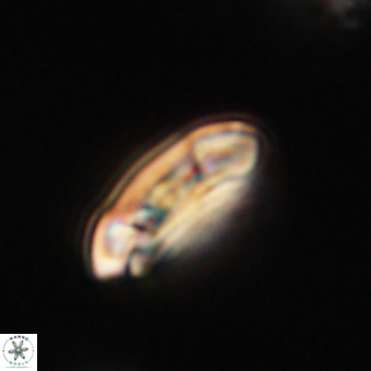 Coccolithus gracejacovidesiae 67881