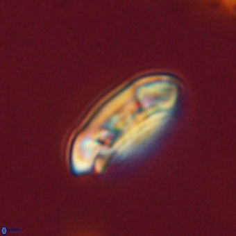 Coccolithus gracejacovidesiae 67882