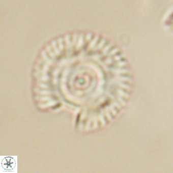 Coccolithus gracejacovidesiae 67887