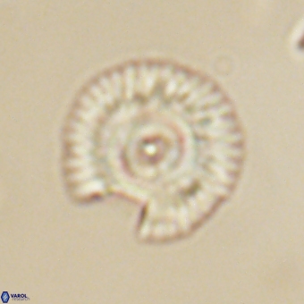 Coccolithus gracejacovidesiae 67888