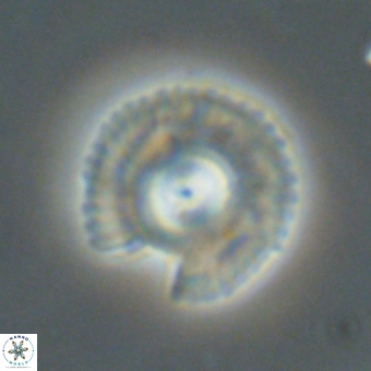 Coccolithus gracejacovidesiae 67891