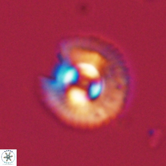 Coccolithus gracejacovidesiae 67908